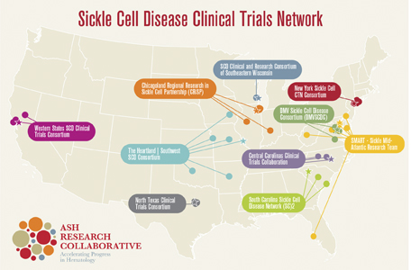 Sickle Cell Disease Clinical Trials Network with U.S. locations marked with dots
