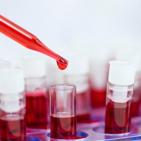 Experts call for more clinical trials on alcohol use, liver disease
