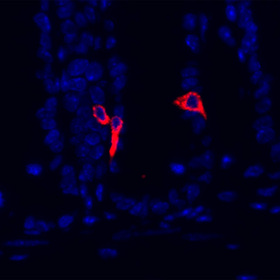 Research could lead to treatments for obesity, extreme weight loss