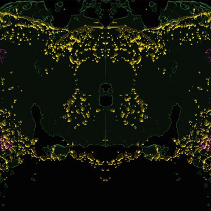 Researchers make molecular connection between blindness, dementia