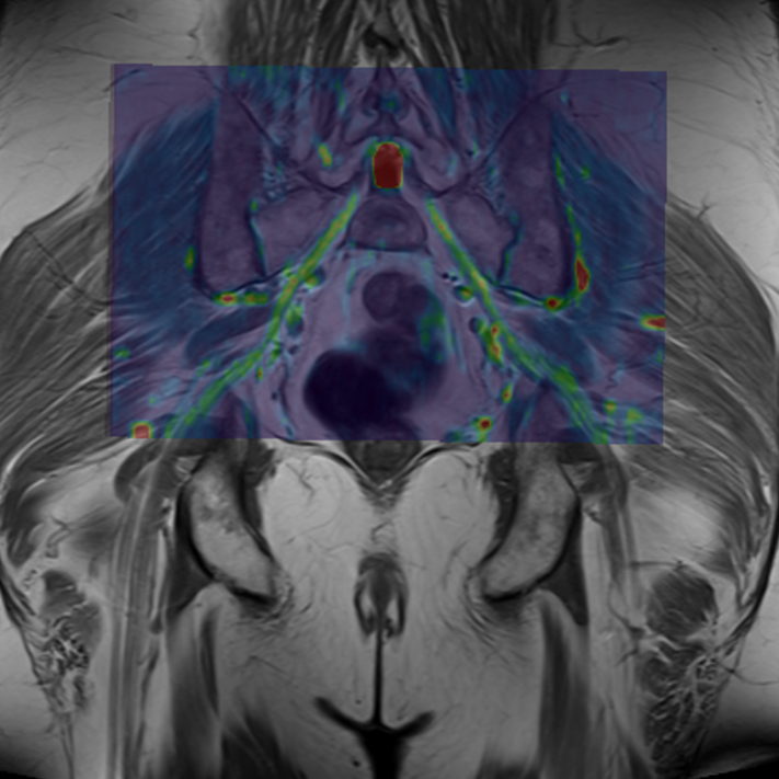 Musculoskeletal Radiology fellowship highlights mentoring