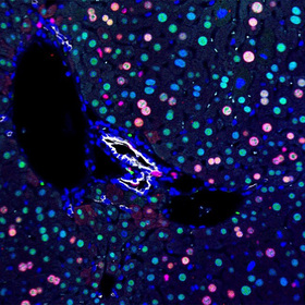 Children’s Research Institute at UT Southwestern identifies metabolic inflexibility that keeps damage at bay during liver regeneration