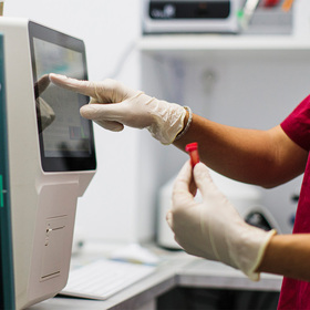 Protein linked to immunotherapy resistance in kidney cancer