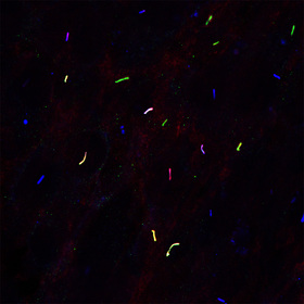 UTSW scientists link another gene to obesity