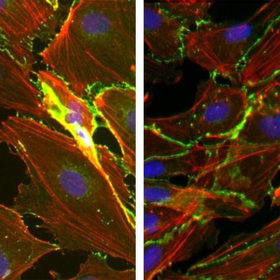Protein plays dual role in causing, preventing sepsis