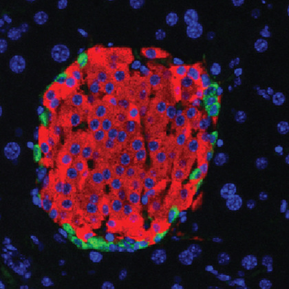 Neonatal diabetes model provides insights on how condition develops
