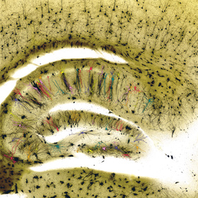 Autism-associated gene alters brain cell identity