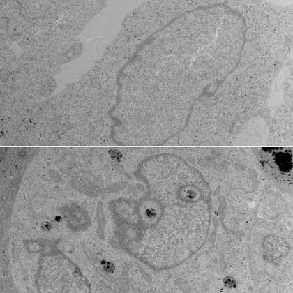 Ridding cells of mitochondria sheds light on their function
