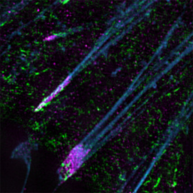 New method identifies protein that may govern cancer cell movement and metastasis