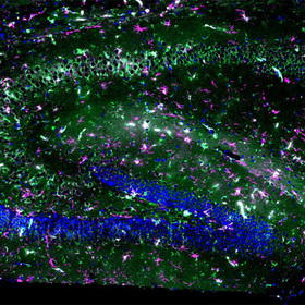 Immune protein STING key for repairing, generating lysosomes