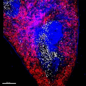 UTSW working to reprogram cells to strengthen immunity in geriatric patients