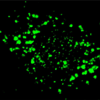 New tool sheds light on where RNA is found in cells