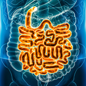 Financial assistance programs improve outcomes for indigent patients with inflammatory bowel disease