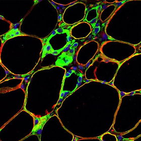 Sensor involved in regulating metabolic health identified
