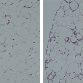 Hormone may hold key to longer life, improved metabolic health