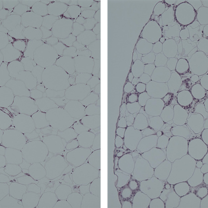 Hormone may hold key to longer life, improved metabolic health