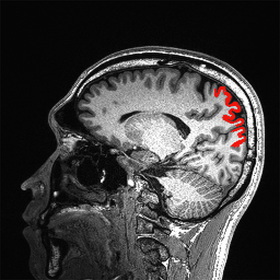Lifelong physical activity may slow cognitive decline