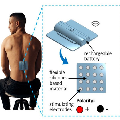 Electrical stimulation offers hope for treating spinal injuries