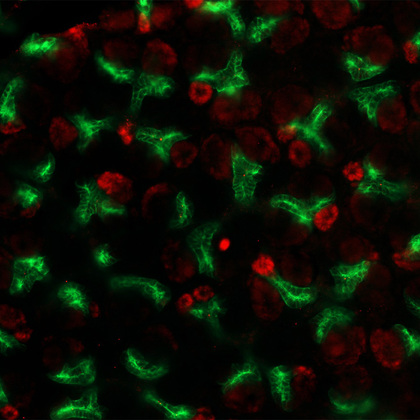 RNA molecular pathway steers stem cells to aid kidney development