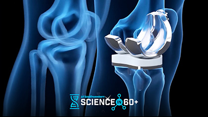 UT Southwestern Science in 60+ logo, blue hourglass over an enhanced x-ray of a prosthetic knee.