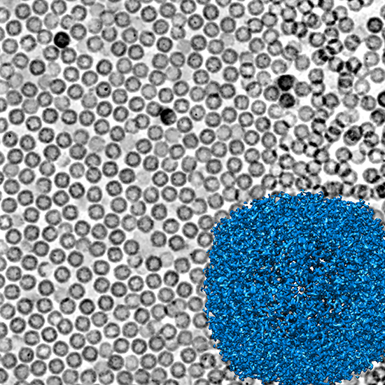 Micrograph of apoferritin proteins Microcope slide covered with small gray circles, with one big blue circle in a corner.