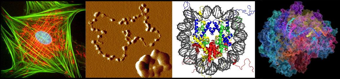 A panel of 4 pictures depicting a stained cell, condensed chromatin, and 2 illustrations of DNA with associated proteins A panel of 4 pictures depicting a stained cell, condensed chromatin, and 2 illustrations of DNA with associated proteins