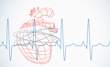 POTS Dysautonomia