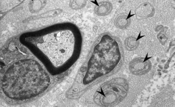 Vernino Lab