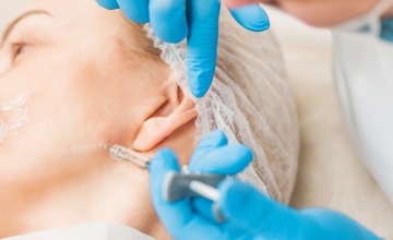 chemodenervation