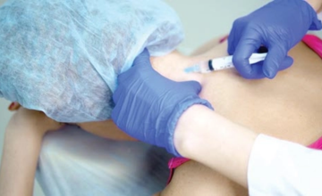 chemodenervation