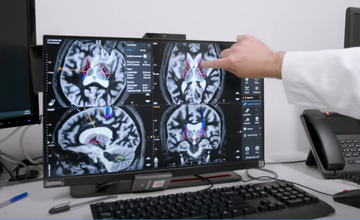 neuromodulation