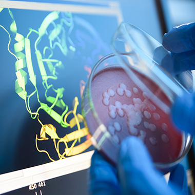 Petri dish in research lab