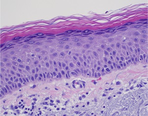 Epidermis Epidermis