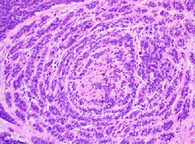 PLGA Slide - 20x