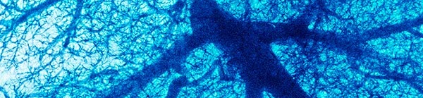 Pulmonary Bronch Pulmonary Bronch