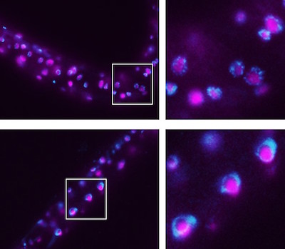 Left: A diagonal line of cells stained blue and magenta, with a box around three in the middle.
Right: An enlarged view, showing blue outlines and solid magenta circles inside.