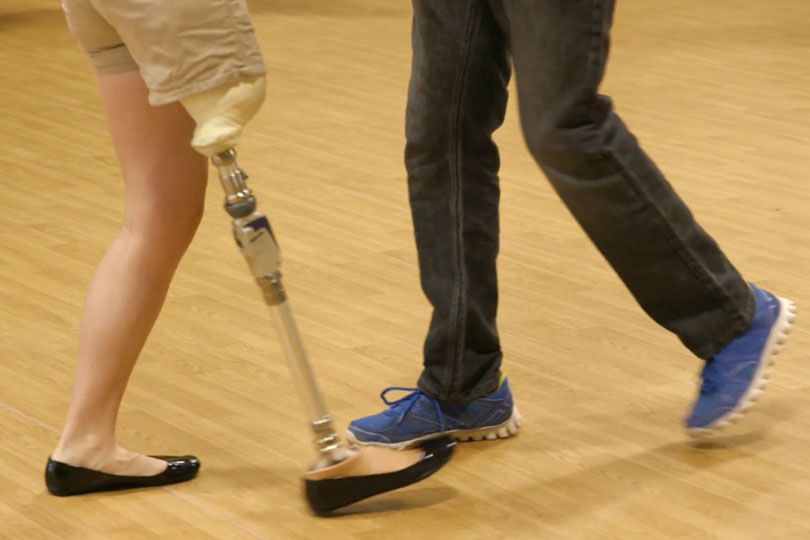 First Dance Outreach Close-up shot of legs, with a woman with a prosthetic leg and a man dancing