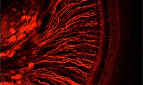 The spiral ganglion (nerves) of the inner ear.