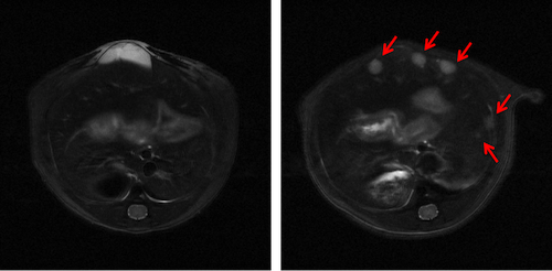 <br> T2WI Longitudinal Images