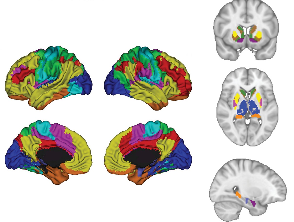 Scientists used artificial intelligence to examine neural activity throughout the brain while study participants processed emotions. Scientists used artificial intelligence to examine neural activity throughout the brain while study participants processed emotions.