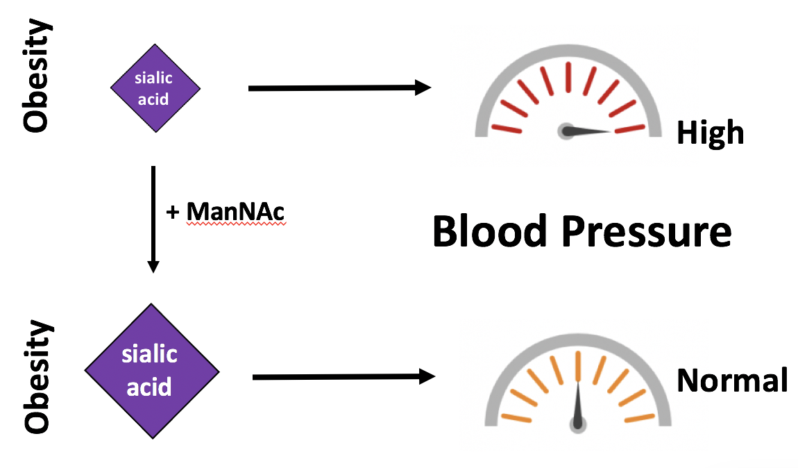 A UTSW study showed that loss of the sugar molecule sialic acid leads to high blood pressure in those who are obese. In obese mice, adding a compound called ManNac restored sialic acid levels and dropped blood pressure back to normal. Researchers are now hoping to test the compound’s effectiveness in people to prevent hypertension. A UTSW study showed that loss of the sugar molecule sialic acid leads to high blood pressure in those who are obese. In obese mice, adding a compound called ManNac restored sialic acid levels and dropped blood pressure back to normal. Researchers are now hoping to test the compound’s effectiveness in people to prevent hypertension.