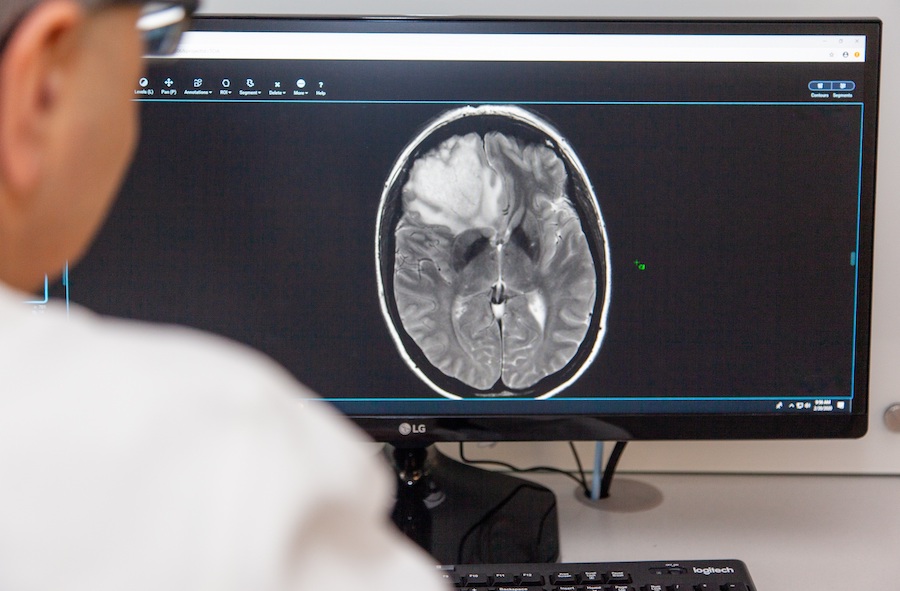 imaging of brain tumor imaging of brain tumor