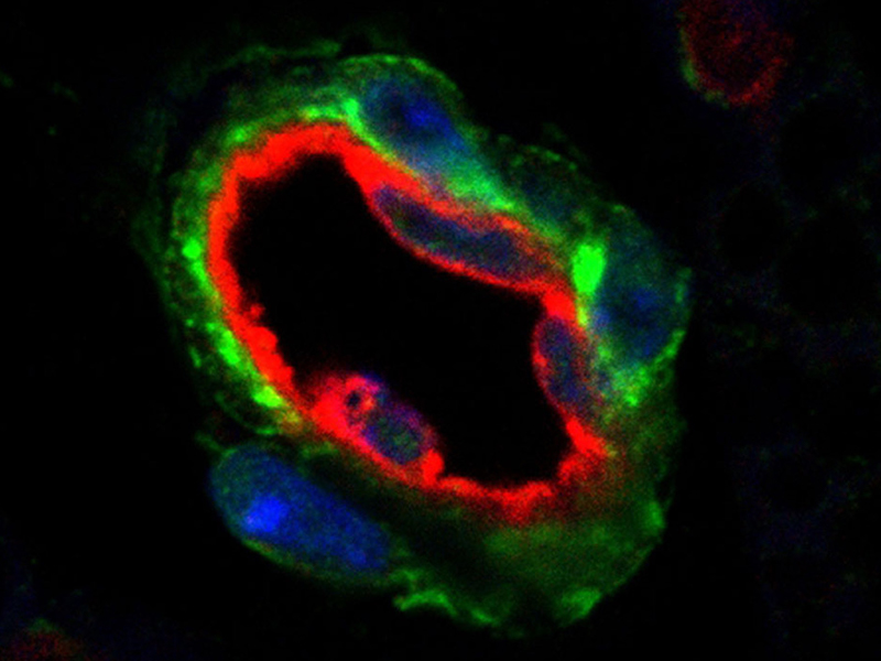 An image showing a blood vessel in fat tissue, surrounded by fat progenitor cells (in green). An image showing a blood vessel in fat tissue, surrounded by fat progenitor cells (in green).