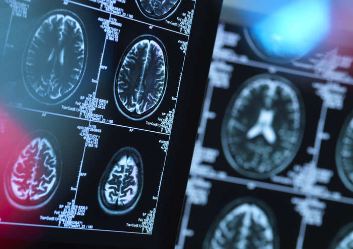 Pediatric brain scan