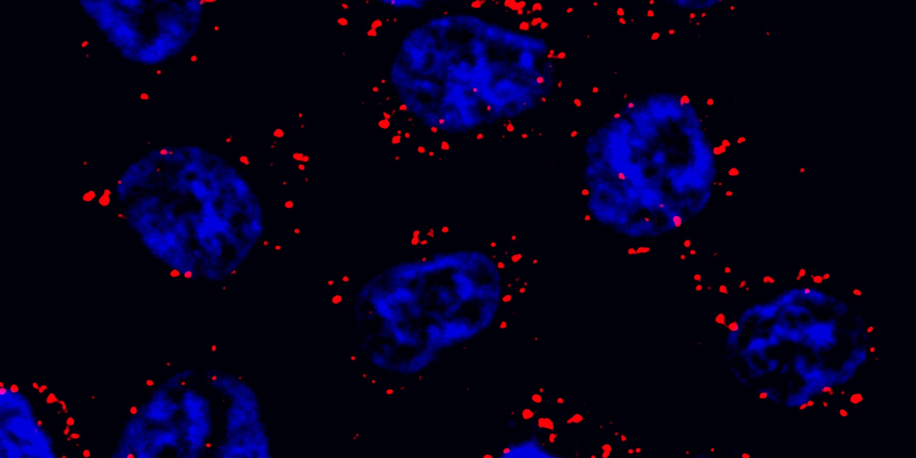 Cells with oil droplet-like ‘NORAD-Pumilio bodies’ in red and nucleus in blue.