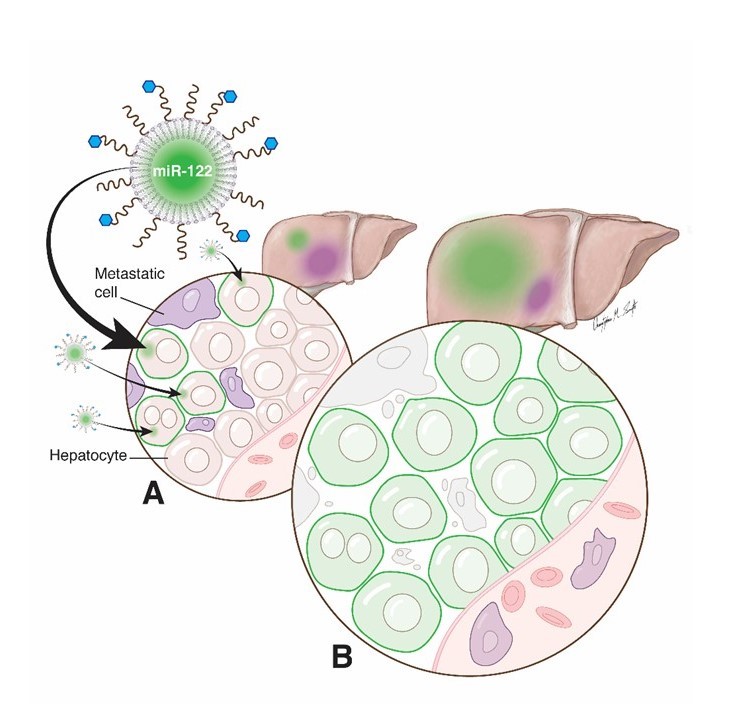 The engineered nanoparticle encapsulates miR-122 in the core and targets hepatocytes using Gal (blue dots). it delivers the miR-122 into hepatocytes which make them “healthier.”