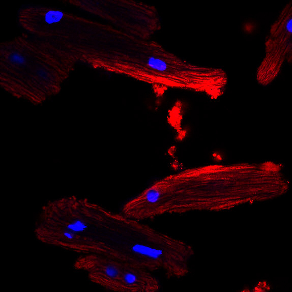 Heart cells that have taken up red colored fat cell-derived extracellular vesicles. Heart cells that have taken up red colored fat cell-derived extracellular vesicles.