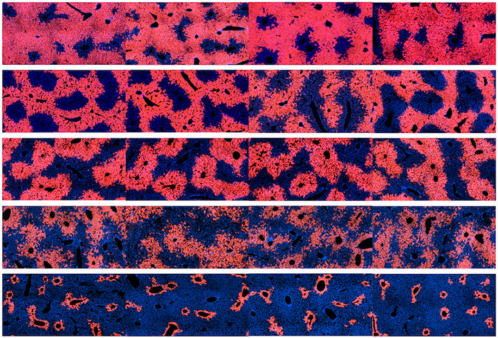 Liver section images
