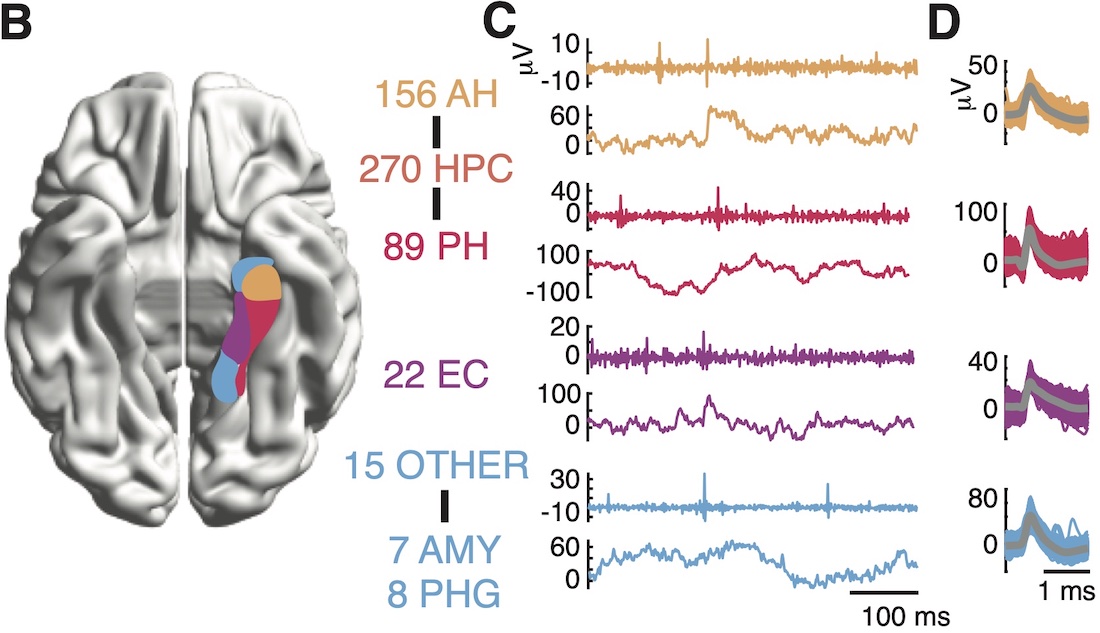 Dr. Bradley Lega and colleagues recorded single-neuron brain activity from memory-relevant regions of the brain