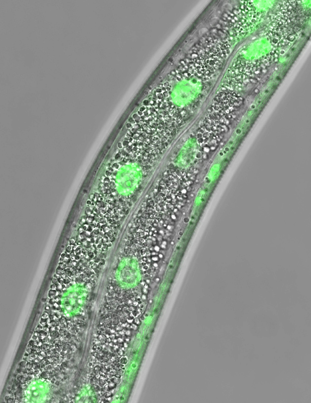 Micrograph of the soil-dwelling worm
